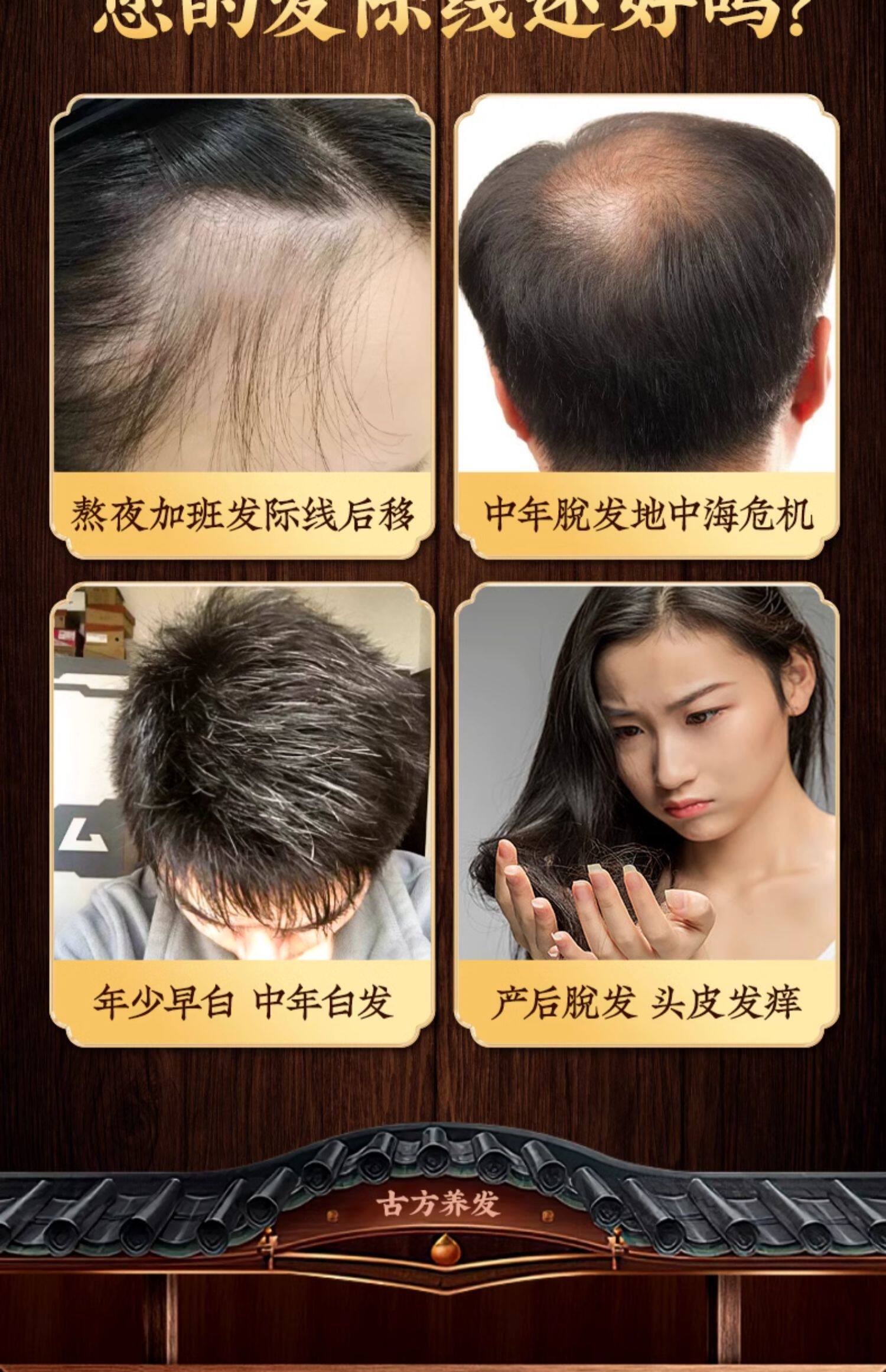 【中国直邮】南京同仁堂   侧柏叶何首乌生姜洗头粉    倪海厦教授推荐  爆发粉   300g/盒