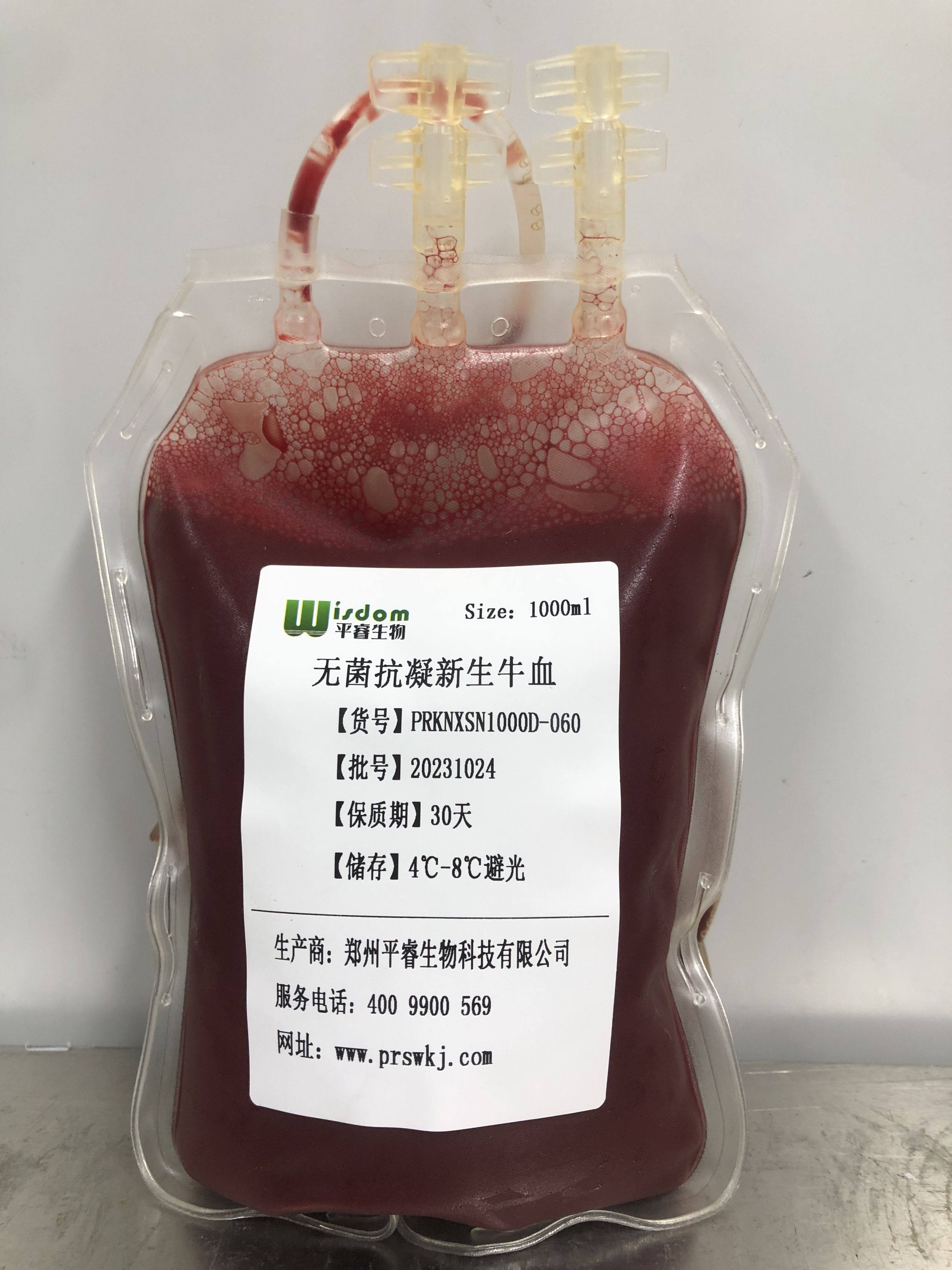 无菌抗凝新生牛血（实验用品，新鲜采集，量大从优）