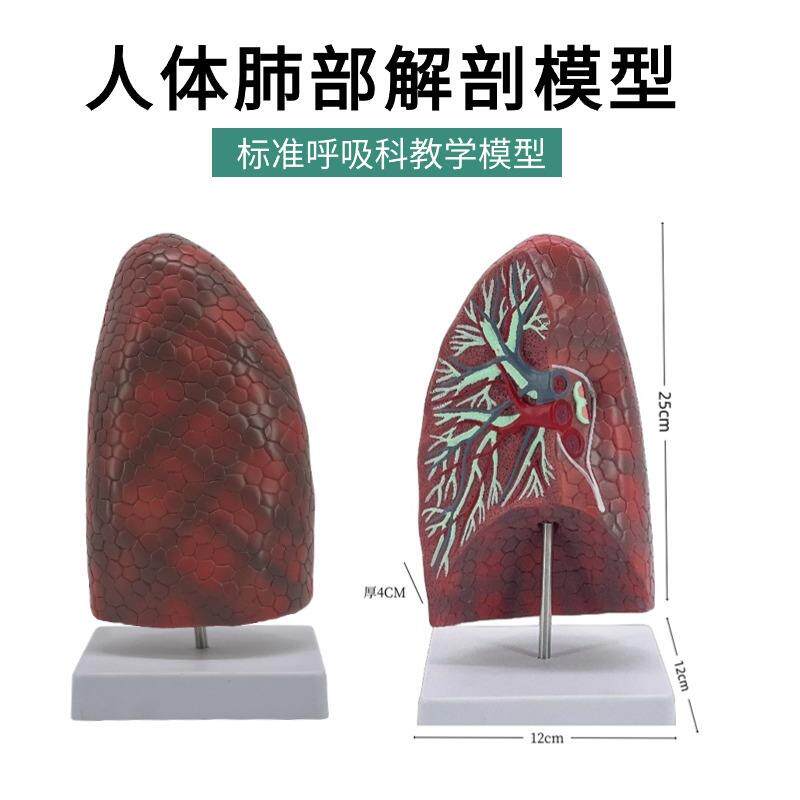 人体自然大肺段模型肺解剖支气管模型呼吸科医药礼品医沟通模型