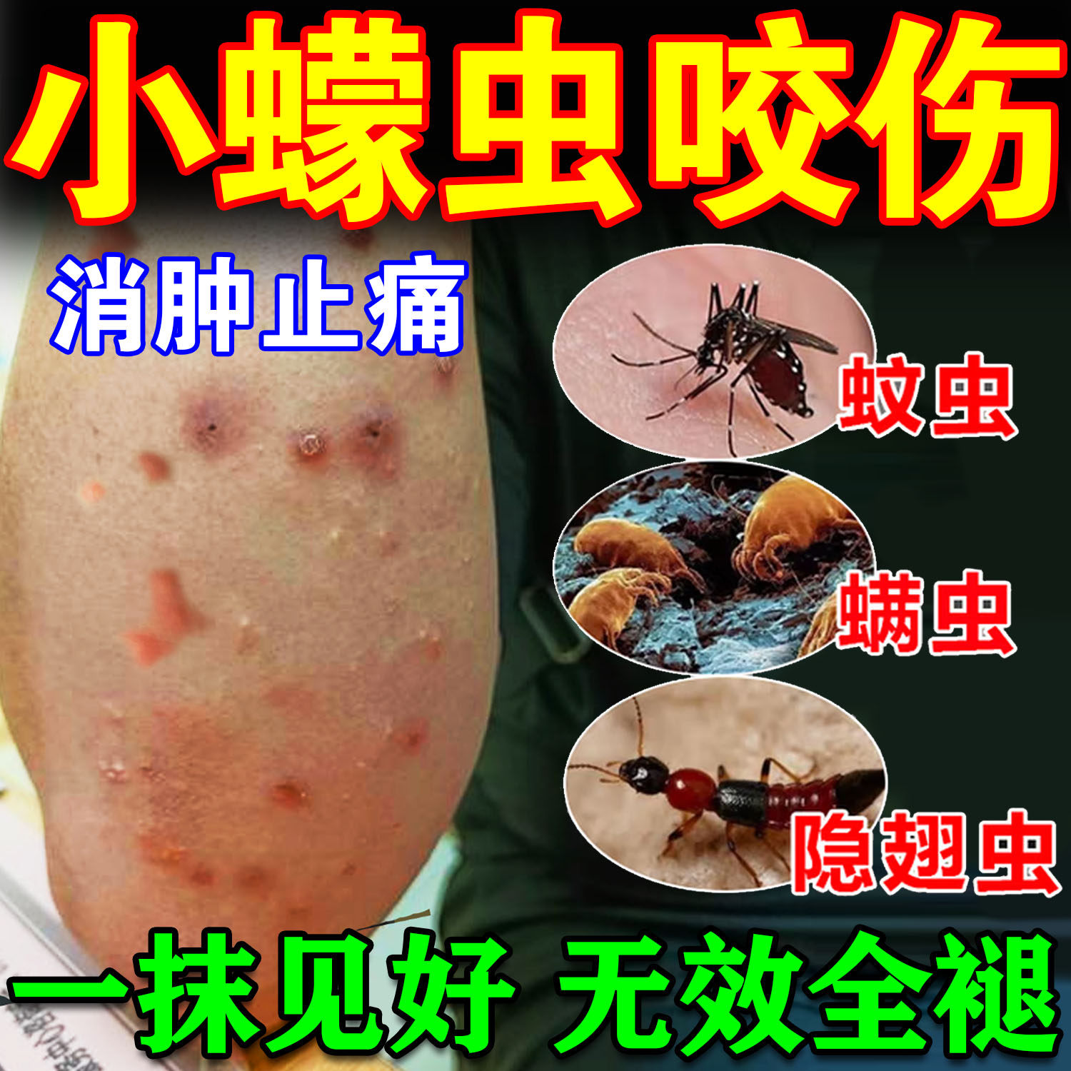 蠓虫咬伤止痒药膏隐翅虫蚊虫叮咬消肿神器防小咬克星蚂蚁瘙痒红肿评价- 淘宝网, image size:1500x1500