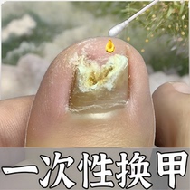 (Watson’s hot sale) One drop can inhibit bacteria without removing nails remove 99% of gray potassium fungi and return the product if it does not work ·