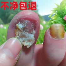 (Tongrentang hot sale) Painless replacement of potassium enjoy a good nail life turn bad nails into good ones drop by drop