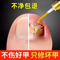 Tongcheng sells 100000 ; no pain - free drop to remove bad potassium gray potassium star