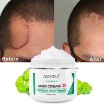 50ML Effectivel Scar Removal Cream Advanced Treatment Face a
