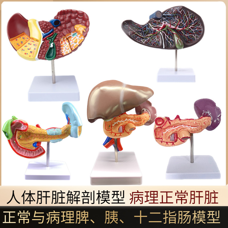 人体肝脏模型肝解剖模型肝胆胰脾十二指肠病变肝胆胰胆囊消化内脏