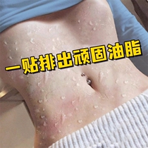 (Recommended by Xiaohongshu) Herbal Mud Moxibustion Recommended by Mom the same model in beauty salons can be used all over the body buy 3 and get 2 free