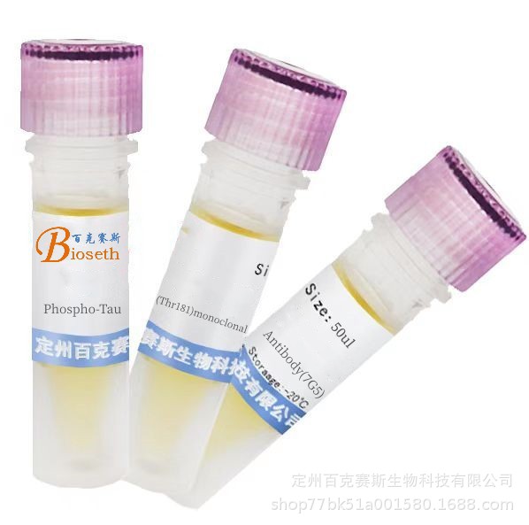 单克隆抗体试剂Phospho-Tau (Thr181)monoclonal Antibody(7G5)
