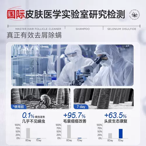 Трюфельный шампунь для кожи головы, удаление перхоти, против зуда, контроль жирного блеска, придает объем