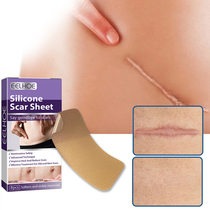 Silicione Gel Efficient Beauty Scalar Remove 1Box=8pcs Self-Ad