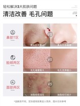 (Watson’s best seller) Don’t squeeze let me expel the dirt and remove the garbage from facial pores. Buy 2 and get 1 free of the same style.