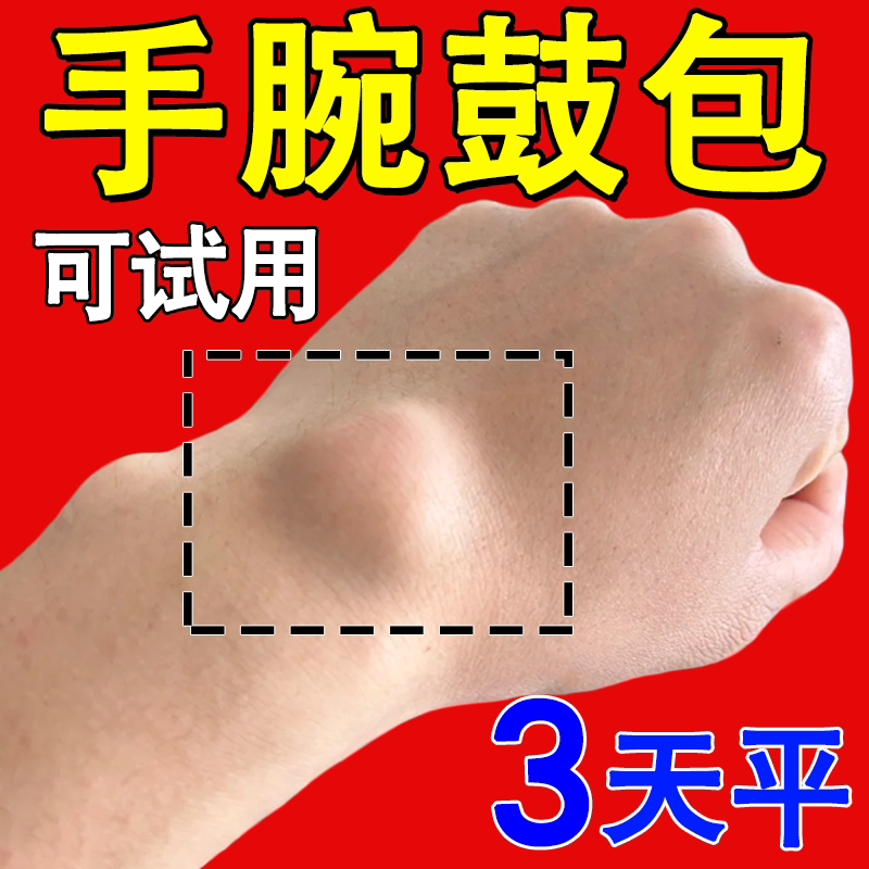 Wrist Swelling, Strain, Stiffness, Numbness, Sprained Instep, Bulging, Deformed Hard Lump, Stiffness, Numbness, General Repair Wrist Swelling, Strain, Stiffness, Numbness, Sprained Instep, Bulging, Deformed Hard Lump, Stiffness, Numbness, General Repair