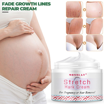 2022 New Pregnancy Repair Cream Stch Marks Removing Acne Sca
