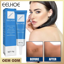 Scar Removal Gel Cream Treatmen Stch Marks Burn Surgical Sca