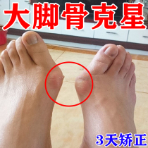 Valgus paste to cure large footed foot footed bone valgus musculature Toe Demasures swollen Pain коррекции божества