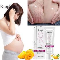 RtopR Pregnancy Scalar Remove Cream Pregant Women Pigment Co