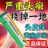 Процентное хлоропрозлочное кремовое лечение кожи экзема псориаз псориаз, не связанный с рецептом, пептический оксил -оксил -пропионат пептат мочевина