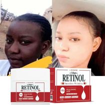 Crema blanqueadora facial y corporal colágeno de Retinol