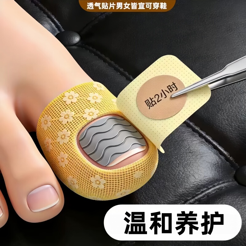 【Hot-Selling Chinese Product】Specialized Nail Removal Patches with Plant Extracts, Genuine Product, Suitable for Both Toenails and Fingernails 【Hot-Selling Chinese Product】Specialized Nail Removal Patches with Plant Extracts, Genuine Product, Suitable for Both Toenails and Fingernails