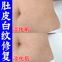 Remove obesity marks stretch marks eliminate stretch marks tighten belly fade lines growth marks on waist and abdomen repair cream