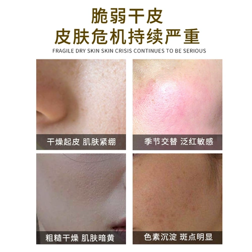 Питательный осветляющий увлажняющий крем для ухода за кожей против сухости, против морщин