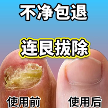 Its too good to not fix it sooner or later its too good a bad nail to change a good A finger toe to repair a good potassium
