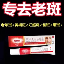 Spot removal cream specializes in removing age spots special face removal cream for hands and back of hands powerful removal
