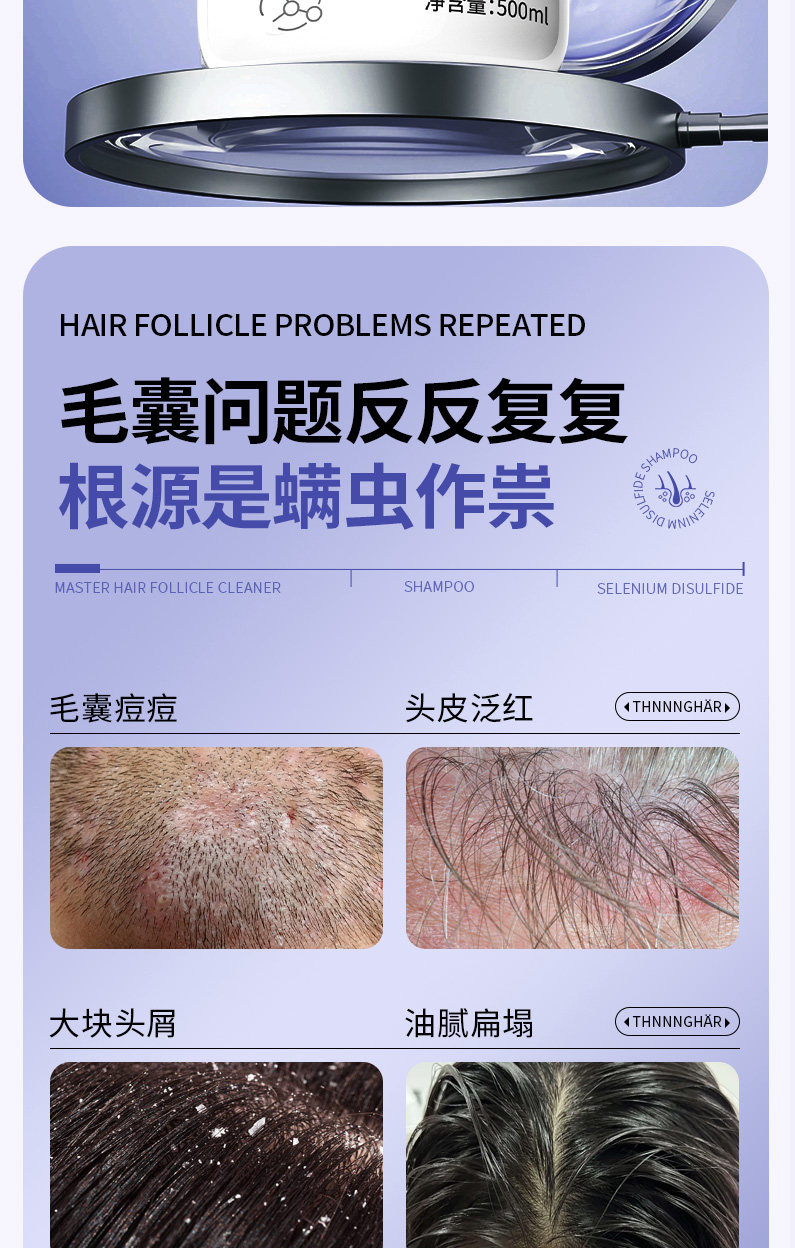 安享好物 安享B级洗发水-植蔻兰二硫化硒洗发水  