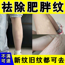 Obesity mark repair cream for pregnant women and postpartum to remove lifting and tightening remove thigh stretch marks obesity marks and growth marks for students