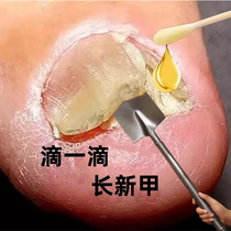 (Tongrentang Hot Sell) No pain for new potassium to enjoy a good A life Bad A to get a good jia drop a drop