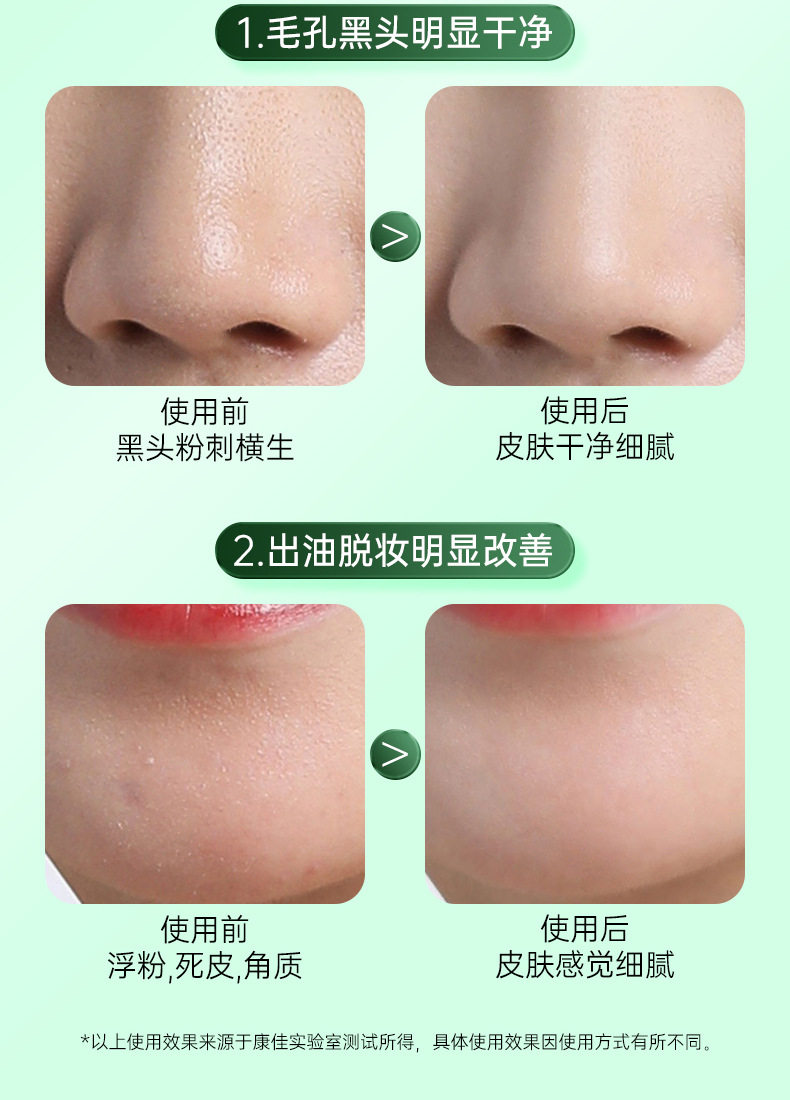 Сосать черный глава инструмент 康佳可视吸黑头仪去黑头铲粉刺电动强力吸出器清洁神器导出美容仪 Konka