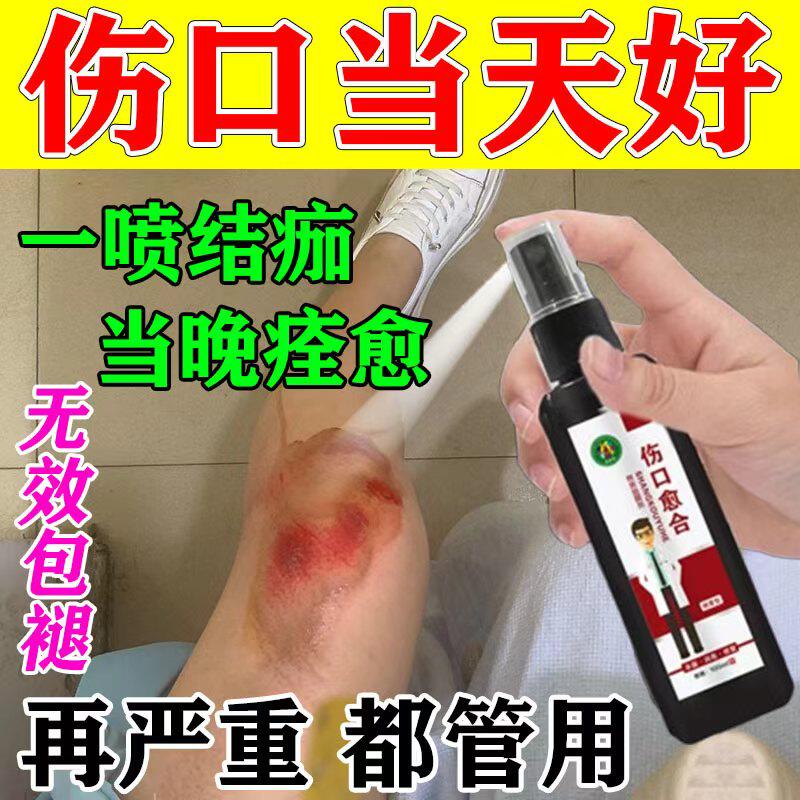 Yunnan Abrasion Hemostasis and Whitening Medicine, Suppurative and ulcerative powder for promoting the healing of sores and wounds by killing flesh bacteria