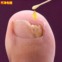 (Watsons best-selling) One drop of it can inhibit bacteria without removing nails and remove 99% of gray potassium fungi. If invalid return guarantee