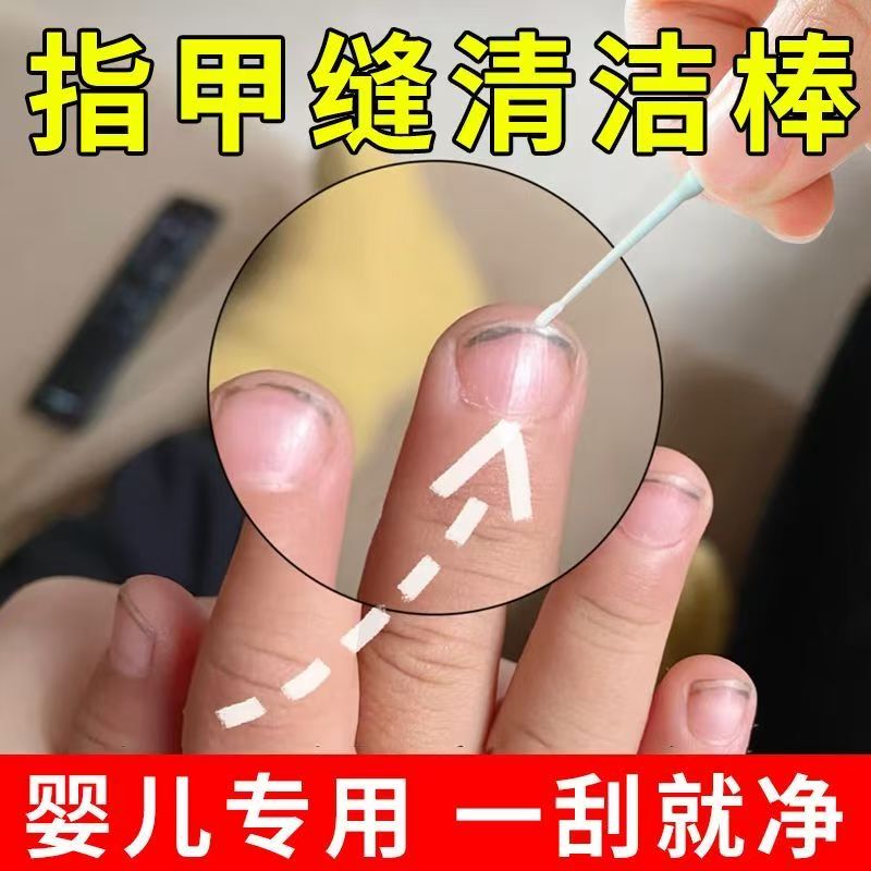 Nail Gap Dirt Cleaner Baby Nail Gap Dirt Cleaning Tool Nail Gap Dirt Cleaning Cotton Swab Does Not Damage Nails Nail Gap Dirt Cleaner Baby Nail Gap Dirt Cleaning Tool Nail Gap Dirt Cleaning Cotton Swab Does Not Damage Nails