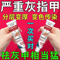 (American Onychomycosis King) Onychomycosis Cream Onychomycosis Onychomycosis Brightening Thickening Onychomycosis Soft Nail Antibacterial Cream