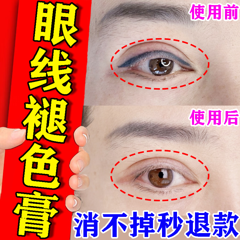 Eyeliner Fade Remover Quickly Fades Tattoo Lines, Removes Colored Contact Lens Lines, Red and Blue Lines, and Eyebrows Without Leaving Traces, Special Magic Cream