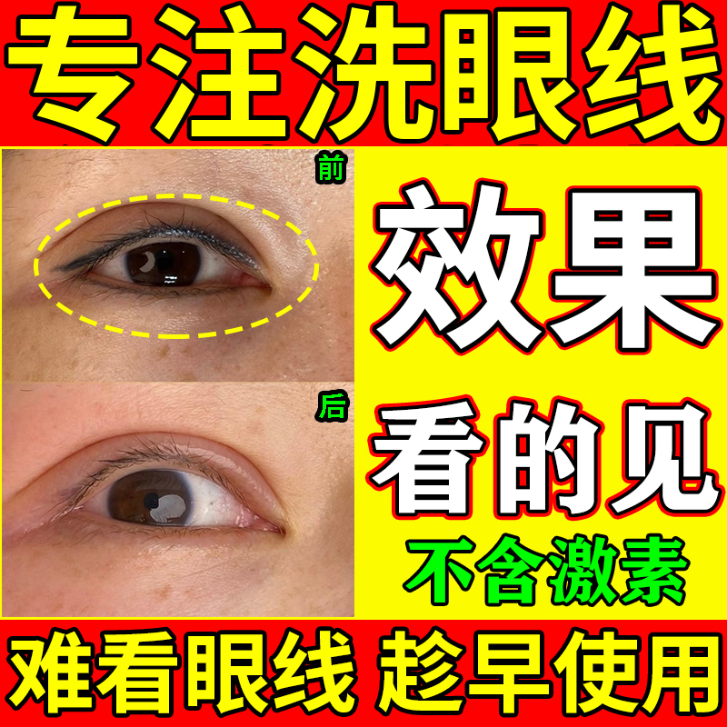 Eyeliner Fading Agent to Remove Tattoos, Quickly Lighten Tattooed Eyebrows, and Clean Eyeliner Marks Without Leaving Scars