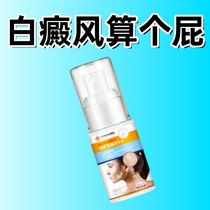 Bai Dianfeng repair solution to quickly eliminate white spots external melanin growth psoralen tincture artifact