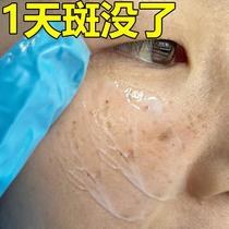 (Xiaohongshu) Remove dark spots spots and blemishes on your face and leave your face clean. Say goodbye to spots~