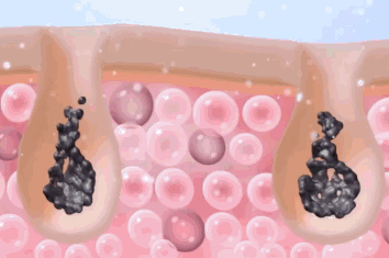 DM_20250408153941_014.gif