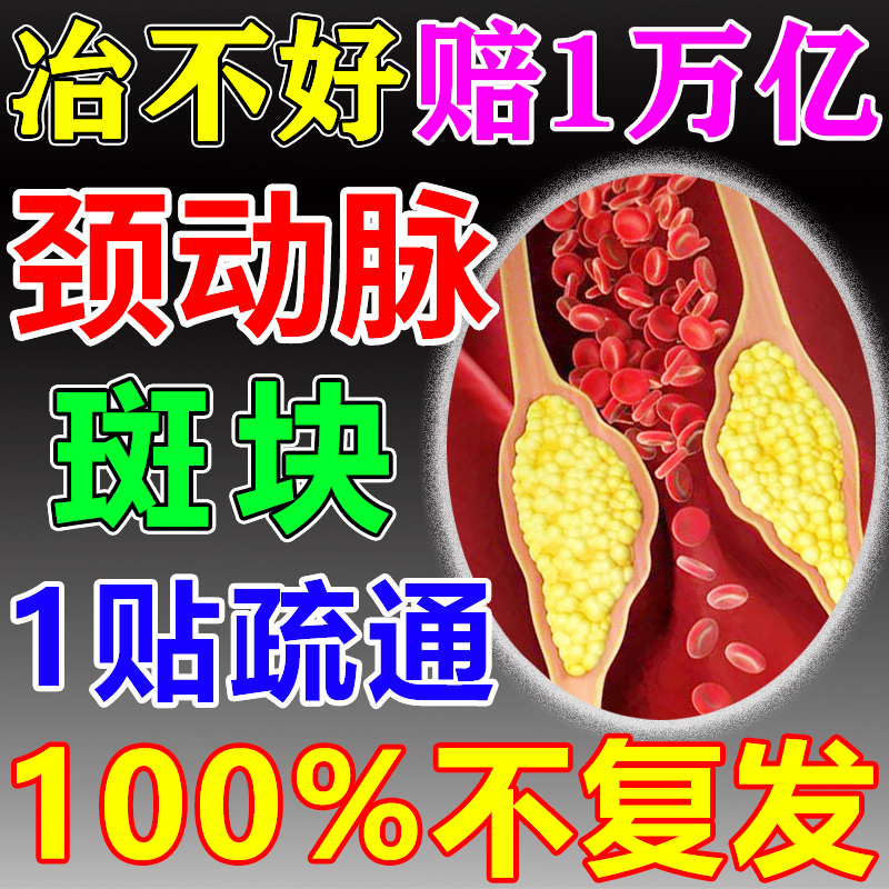 Medicinal Patches to Eliminate Carotid Artery Plaques, Treat Vascular Blockages and Narrowings, and Relieve Insufficient Blood Supply to the Brain Medicinal Patches to Eliminate Carotid Artery Plaques, Treat Vascular Blockages and Narrowings, and Relieve Insufficient Blood Supply to the Brain