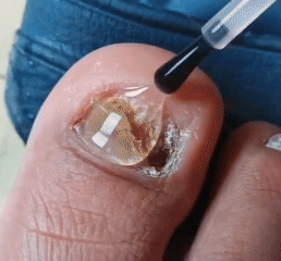 16.gif