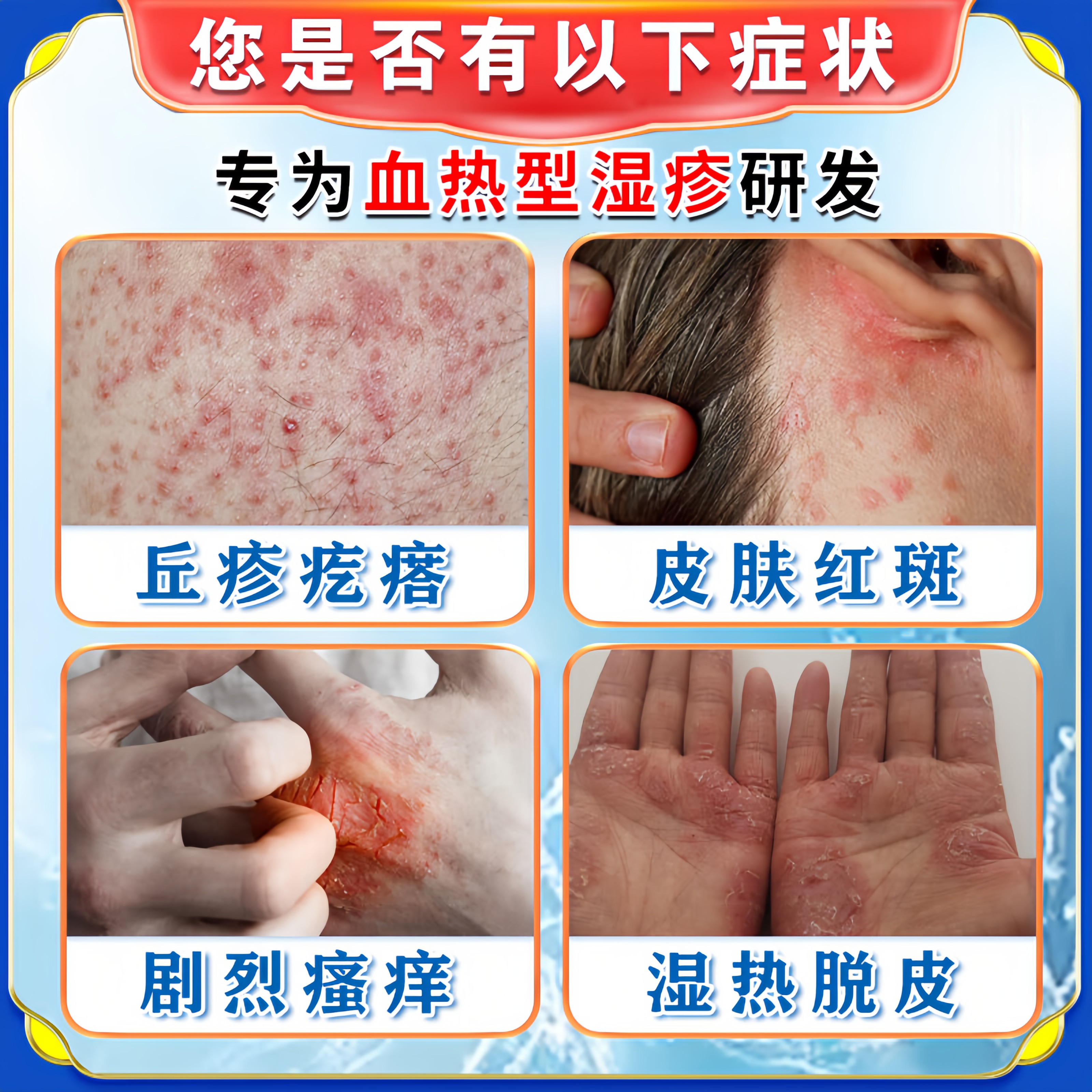 血热型湿疹救星!盐酸赛庚啶片24.80真的靠谱吗?_游戏皮肤_淘宝游戏网