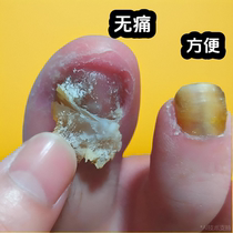 Tongrentang hot sale (grow new nails in seven days). One drop of it can turn bad nails into good ones and grow new nails. It can inhibit bacteria without removing nails.