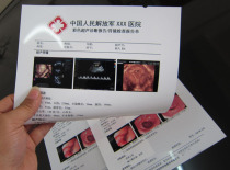 New hospital film porcelain white inkjet film A4 film gastroscopy B-ultrasound four-dimensional color ultrasound printing Z paper 100