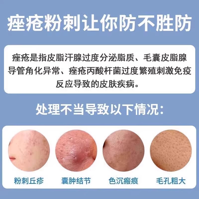 王老吉清热暗疮丸，玫瑰痤疮救星？🌟深度解析与使用体验-皮脂汗腺-淘宝好物网