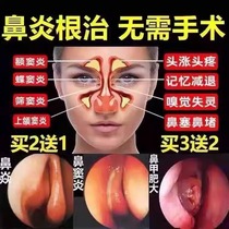 Goose does not eat grass rhinitis ointment sinusitis nasal congestion turbinate hypertrophy special medicine for cocklebur rhinitis tablets official website