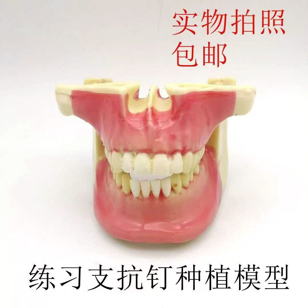 牙科口腔 支抗钉练习模型 支抗钉牵引 种植牙教学操作上颌窦提升