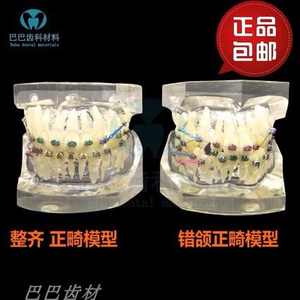 错颌展示模型扎丝正畸口腔模型透明牙齿模型牙科教学模型