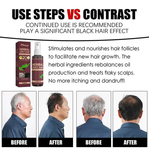 Спрей Grey Hair Reverse Herbal Spray увлажняет, разглаживает и ухаживает за волосами.