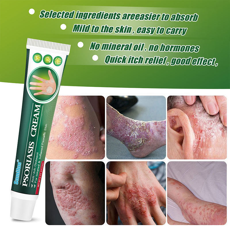 Xiumei Дао psoriasis cream skin ringworm net cream anti-itch ointment Other
